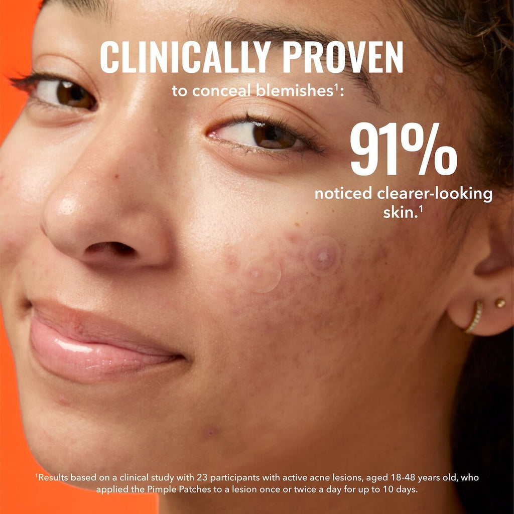pimple-patches-d1 zb_p.jpg