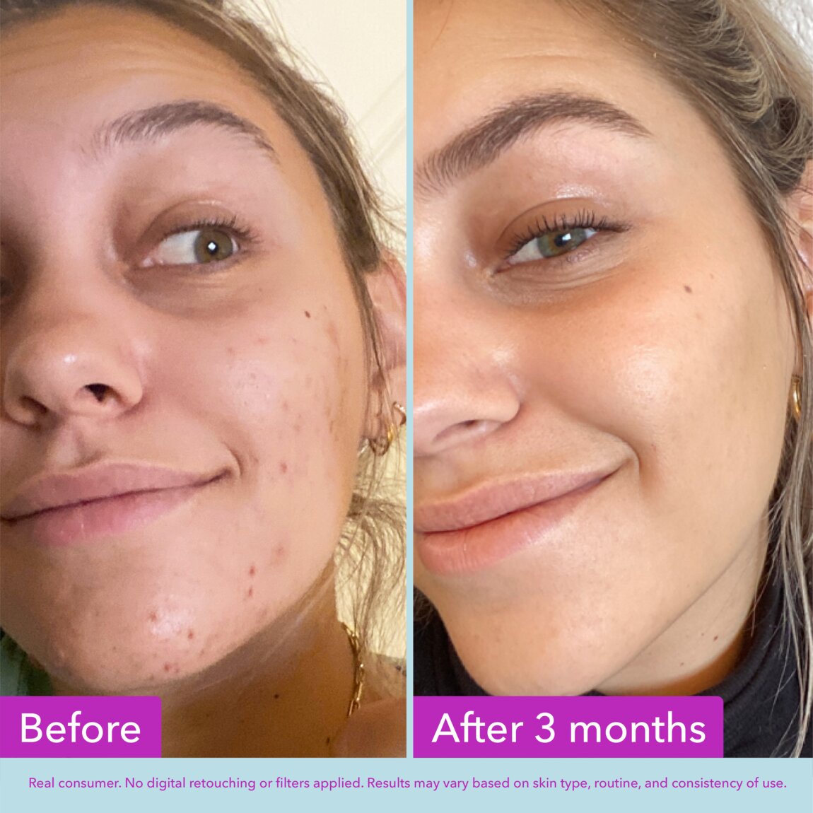 niacinamide-brightening-toner-g7 zb_p.jpg