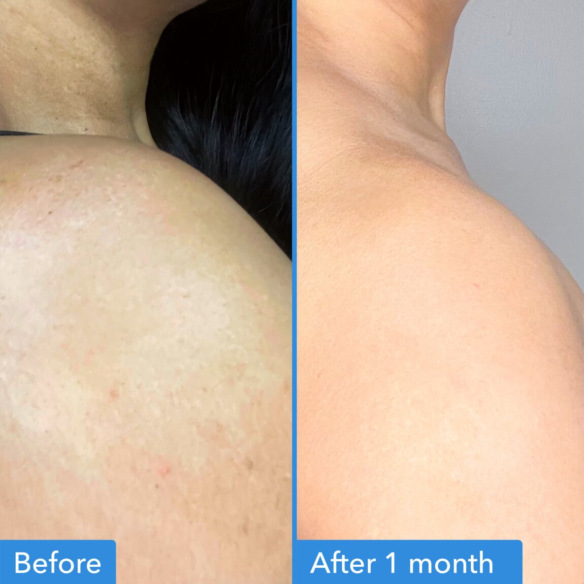 discoloration-correcting-body-treatment-i5 zb_p.jpg
