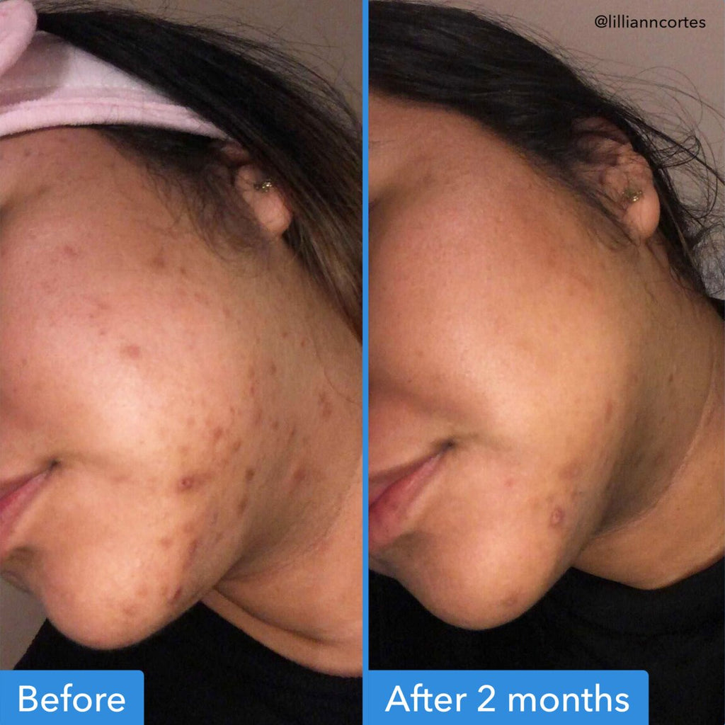 discoloration-correcting-serum-m5 zb_p.jpg