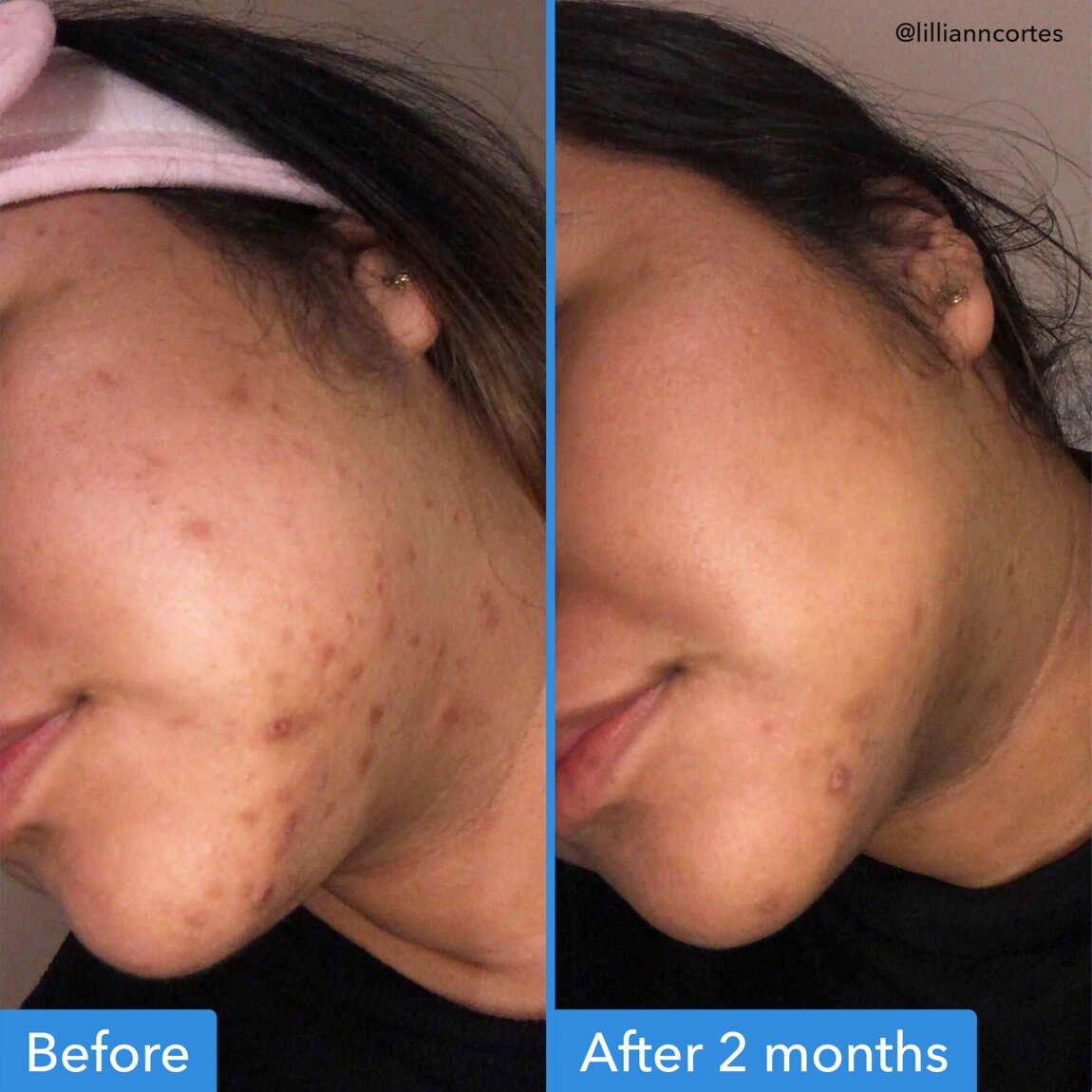 discoloration-correcting-serum-m5 zb_p.jpg